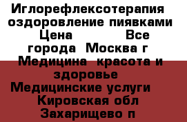 Иглорефлексотерапия, оздоровление пиявками › Цена ­ 3 000 - Все города, Москва г. Медицина, красота и здоровье » Медицинские услуги   . Кировская обл.,Захарищево п.